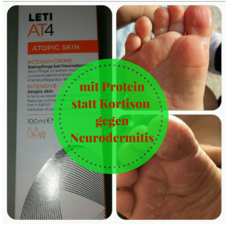 LetiAT4 gegen Neurodermitis